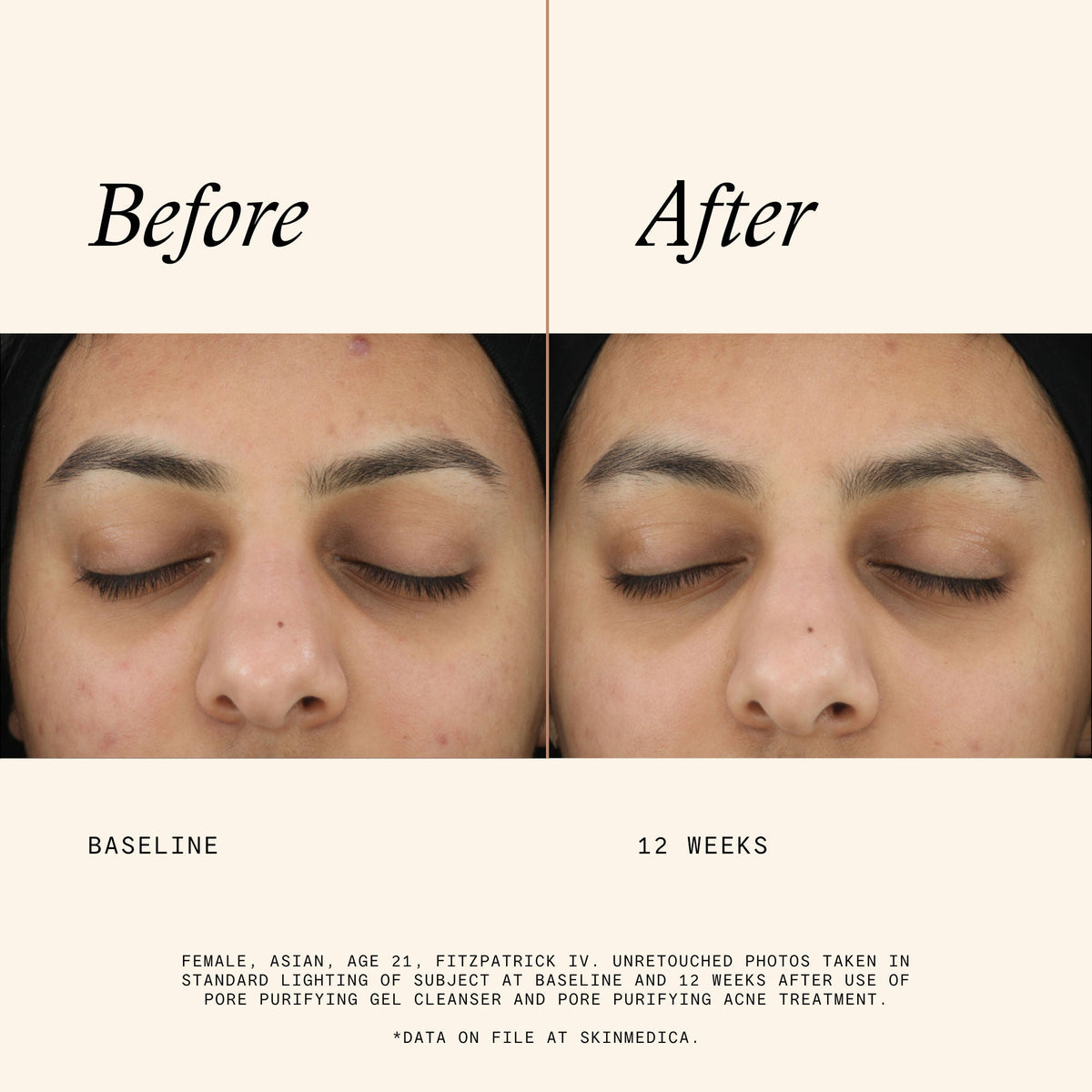 Pore Purifying Gel Cleanser