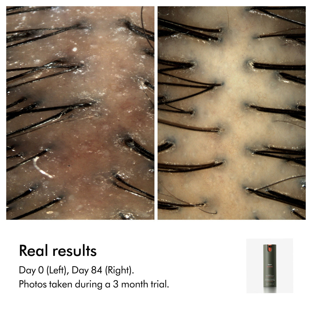 Amino Balance & Strengthen Scalp Treatment for Fuller Looking Hair