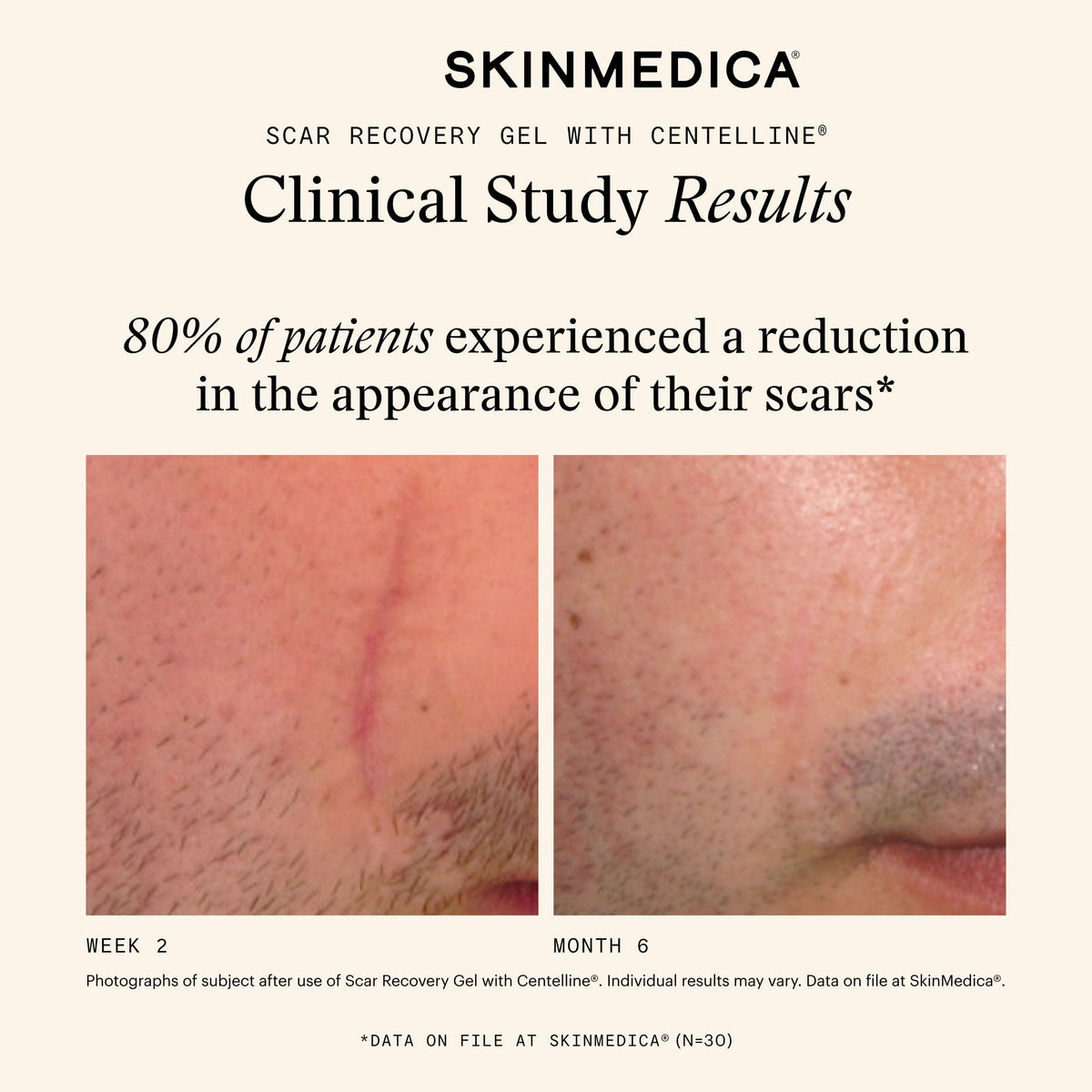 Scar Recovery Gel