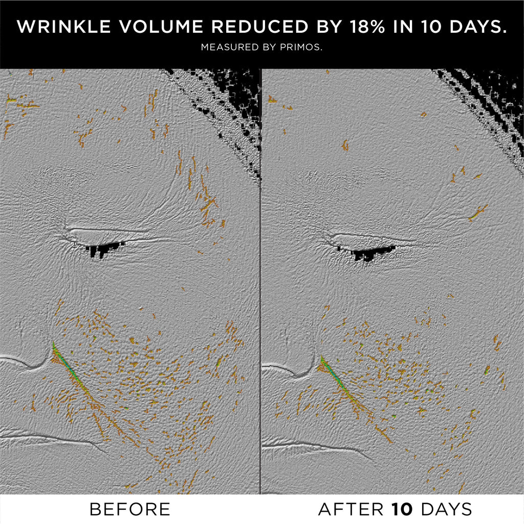 The Exceptional RetiNAD+ Renewal Booster