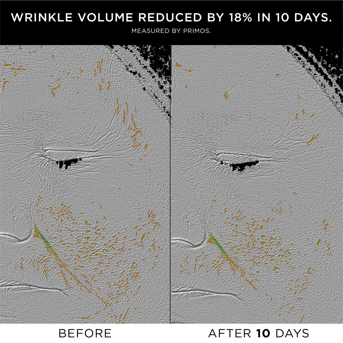 The Exceptional RetiNAD+ Renewal Booster