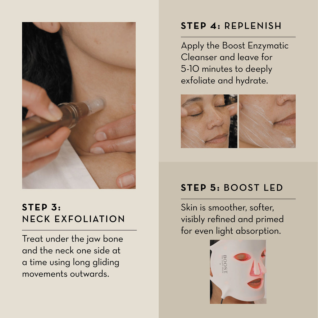 Boost Nano-Dermabrasion & Nano-Infusion Pen