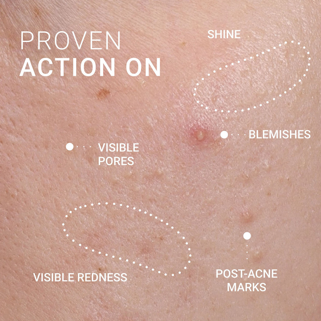 Corrective Serum for Skin Imperfections
