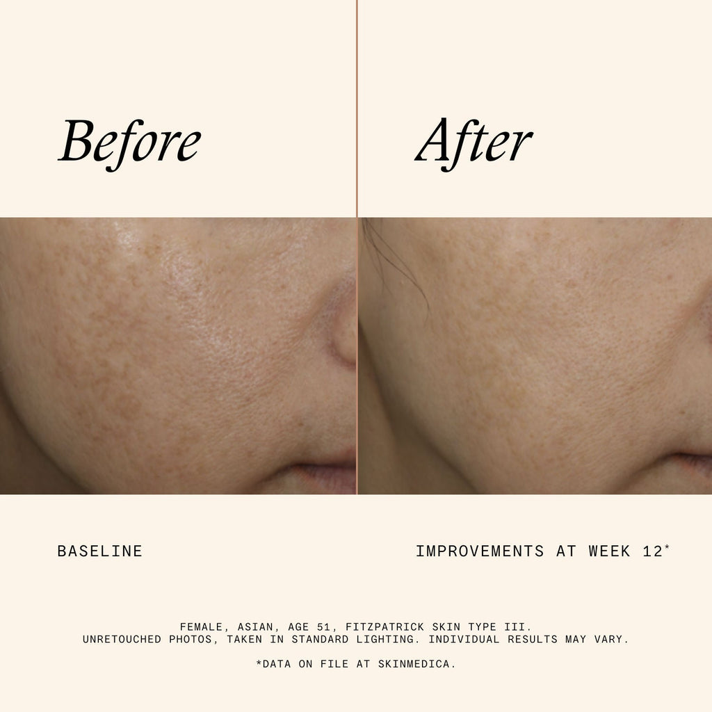 Even & Correct Advanced Brightening Treatment