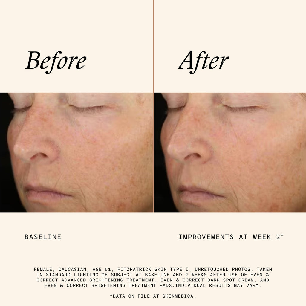 Even & Correct Brightening Treatment Pads