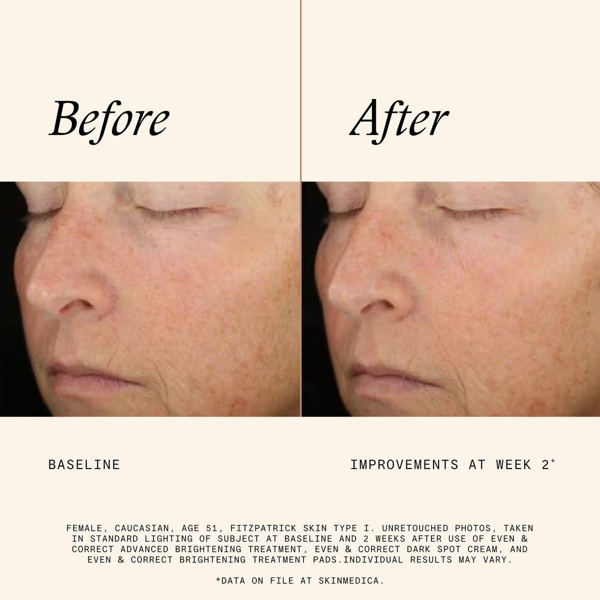 Even & Correct Brightening Treatment Pads
