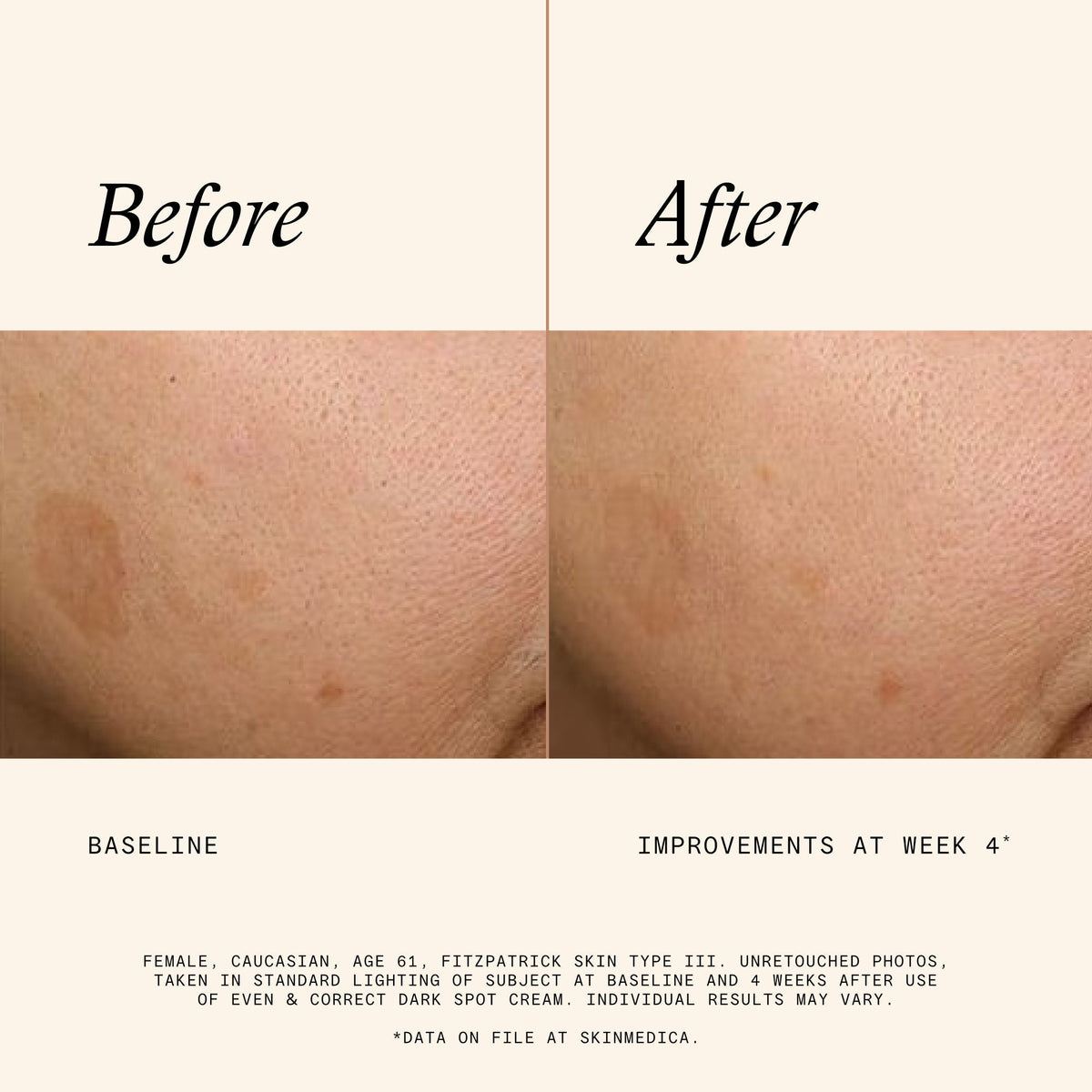 Even & Correct Dark Spot Cream