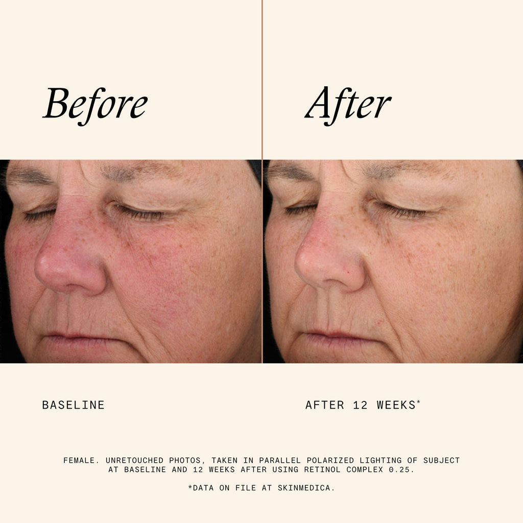 Retinol Complex 0.25