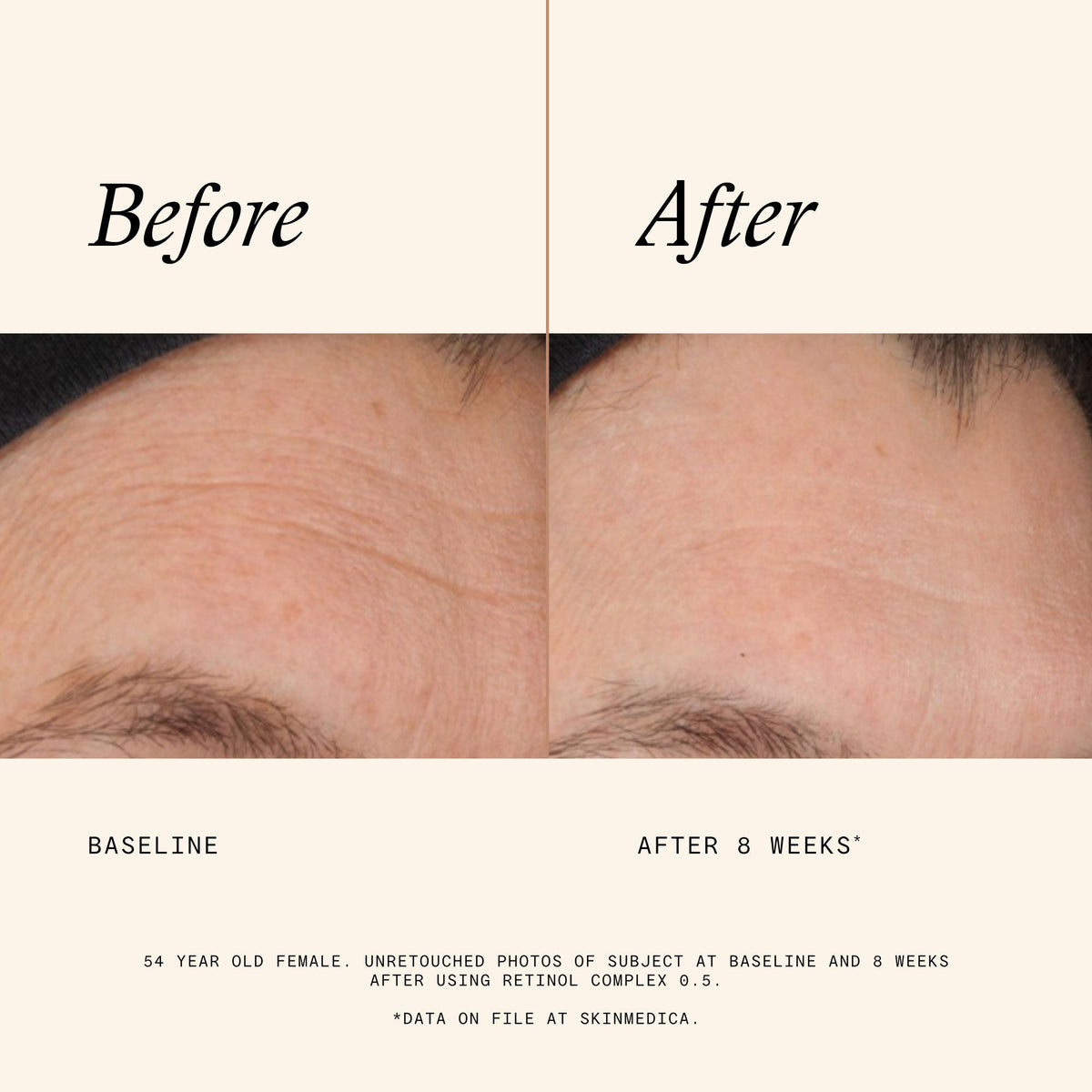 Retinol Complex 0.5
