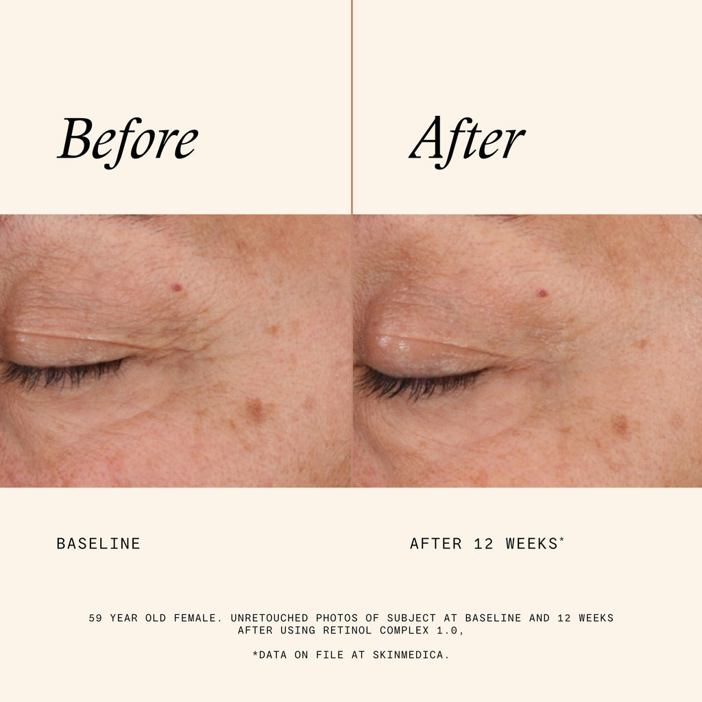Retinol Complex 1.0