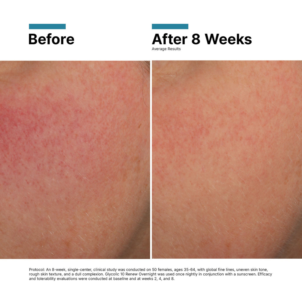 Glycolic 10 Renew Overnight