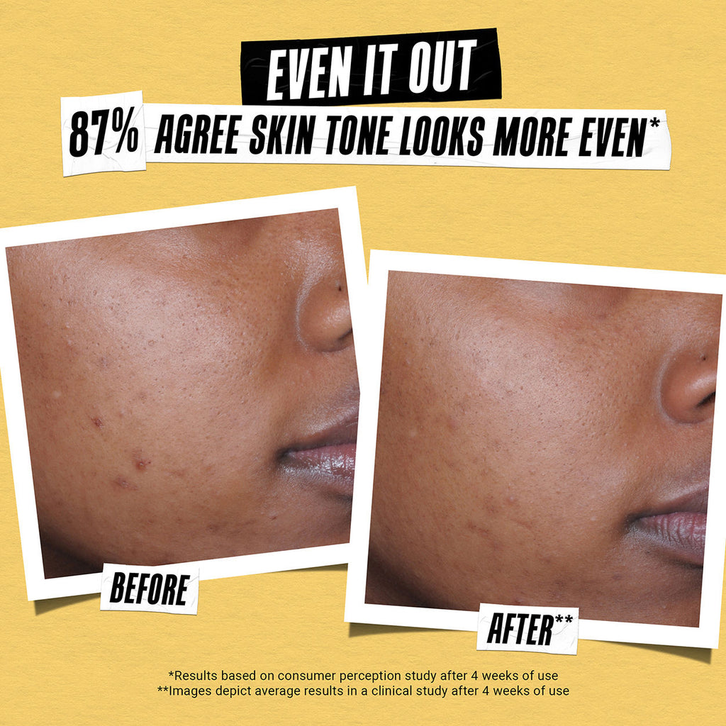 Better Screen UV Serum SPF 50+