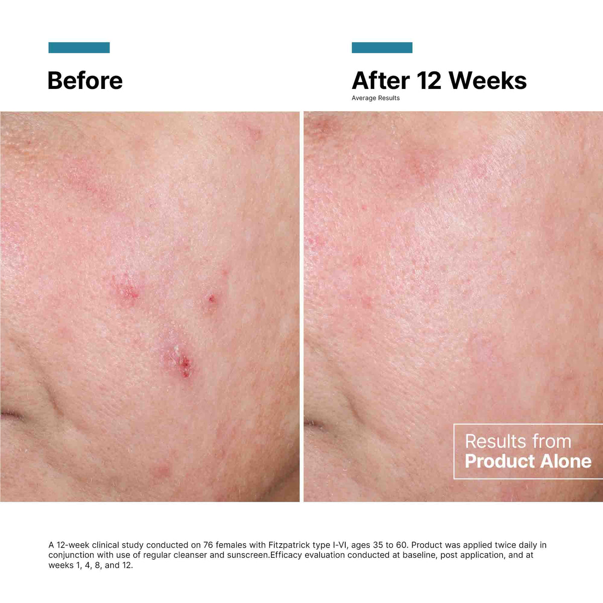 Advanced RGN-6 Regenerative Cream