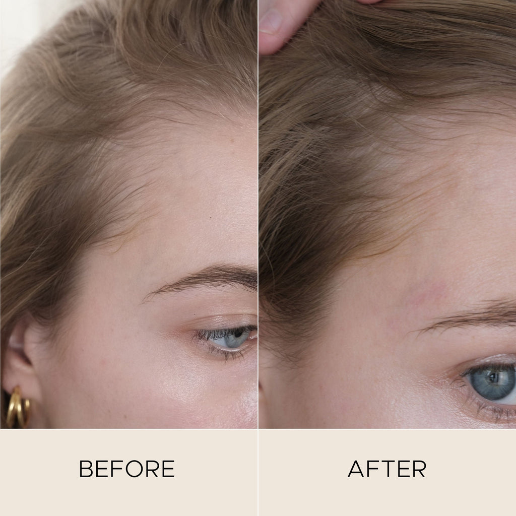 Fortifying Scalp Serum with Amaranth Peptides