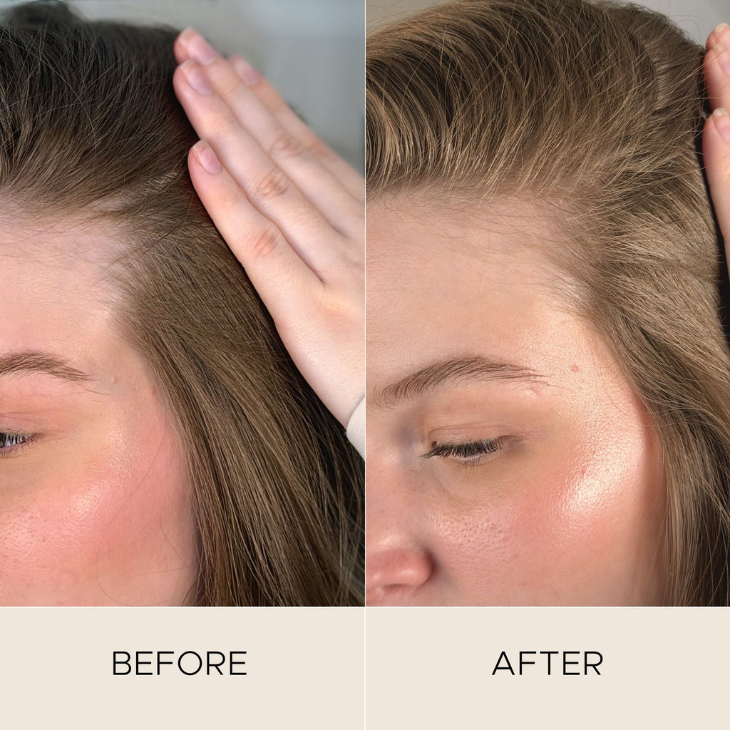 Fortifying Scalp Serum with Amaranth Peptides