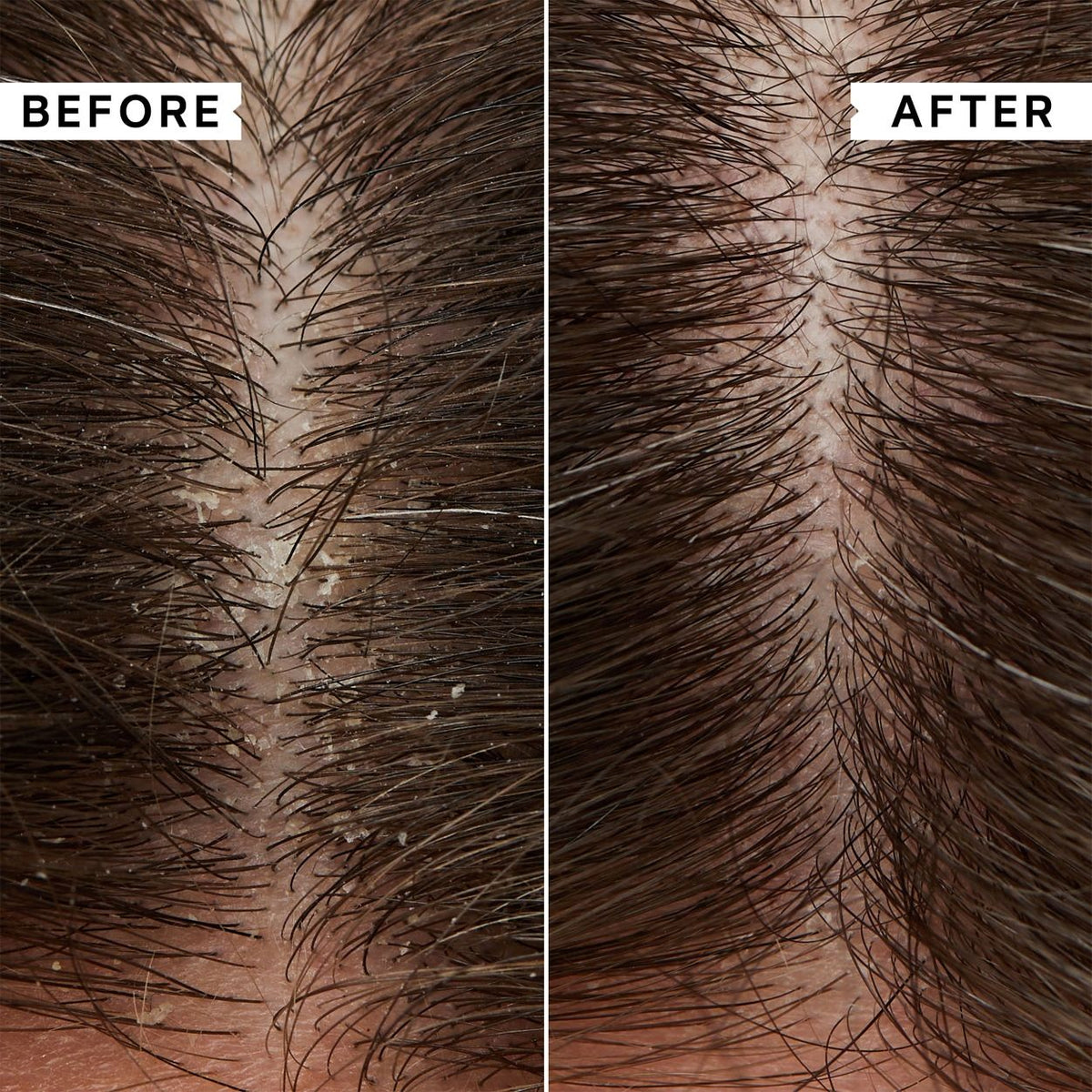 Flaky Scalp Calming Toner