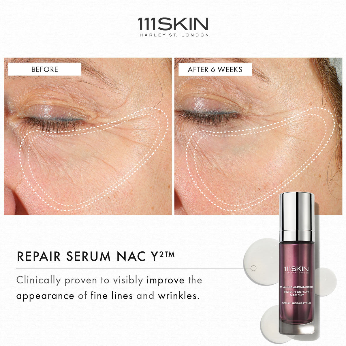 Repair Serum NAC Y2