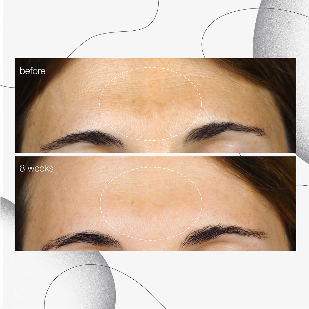 PowerBright Dark Spot Serum