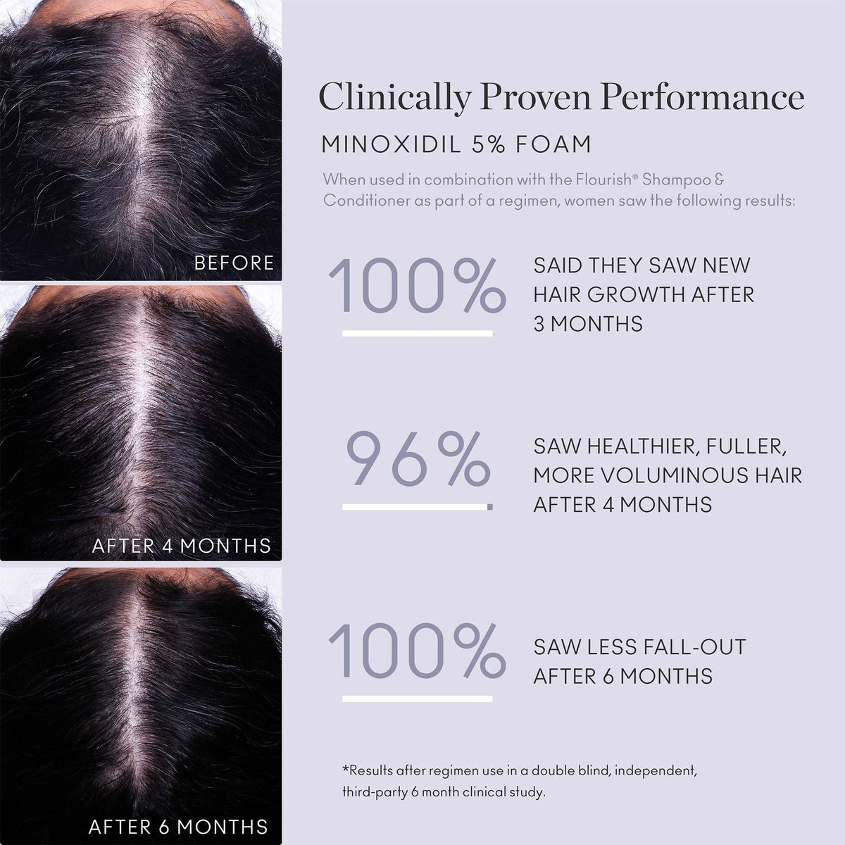 Flourish Minoxidil Foam