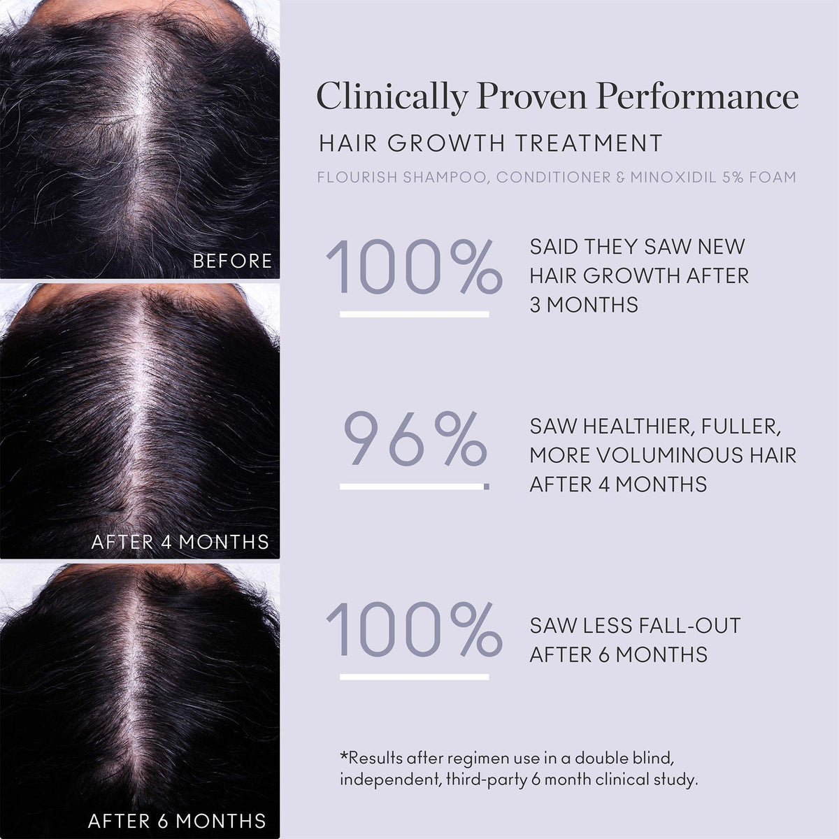 Flourish Nightly Intensive Hair Growth Treatment 90 Day