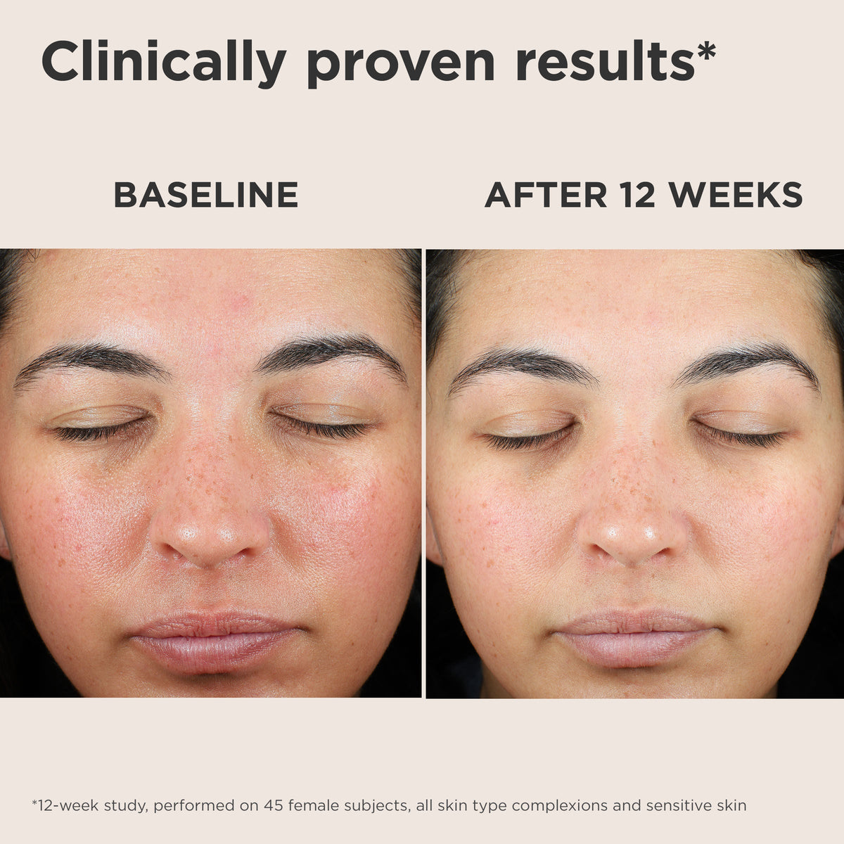 UV Skin Recovery Broad Spectrum SPF 50