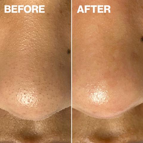 Dermapore+ Blush