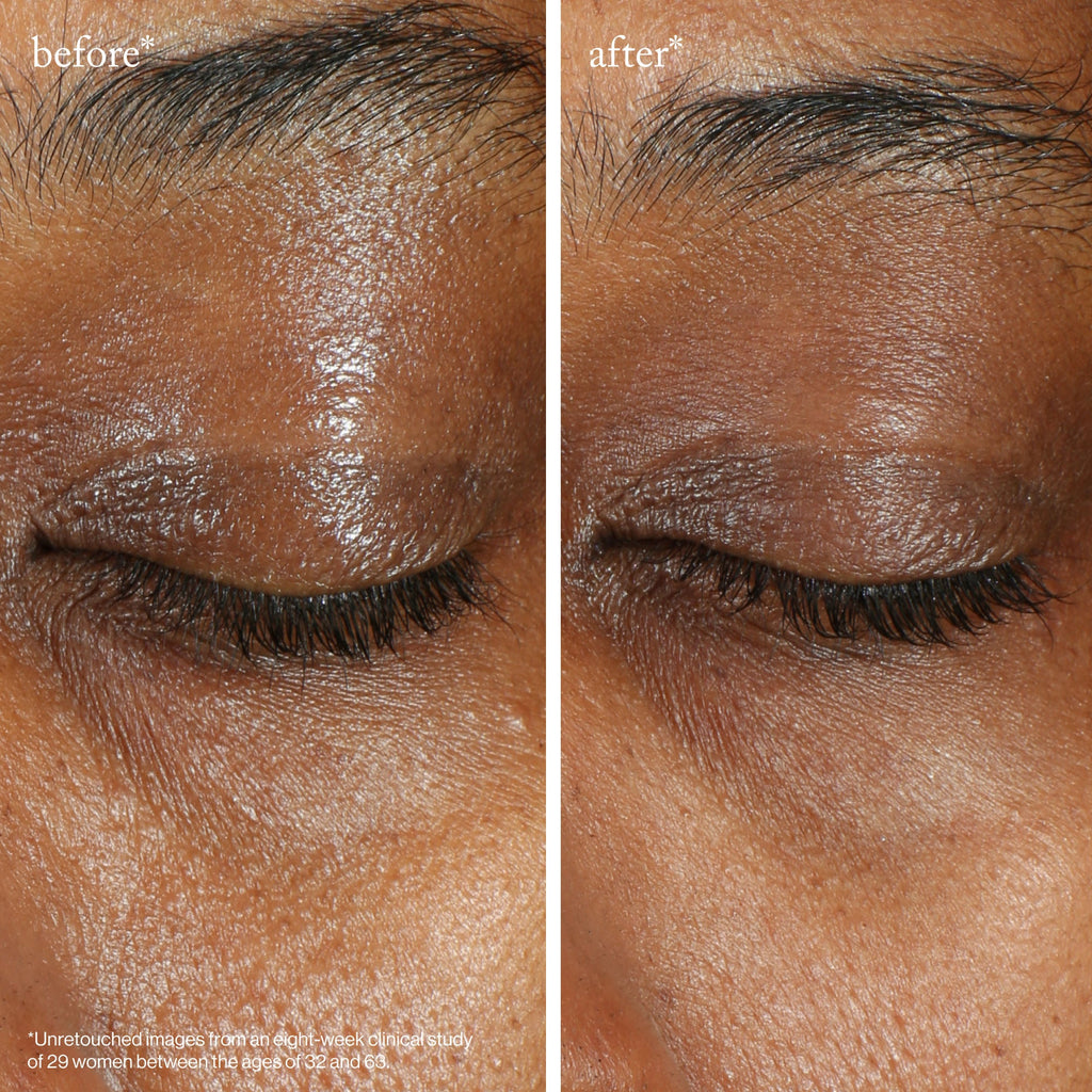 Vita-C Brightening Eye Cream
