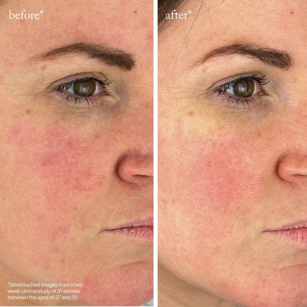 Youth-Boost Peptide Serum