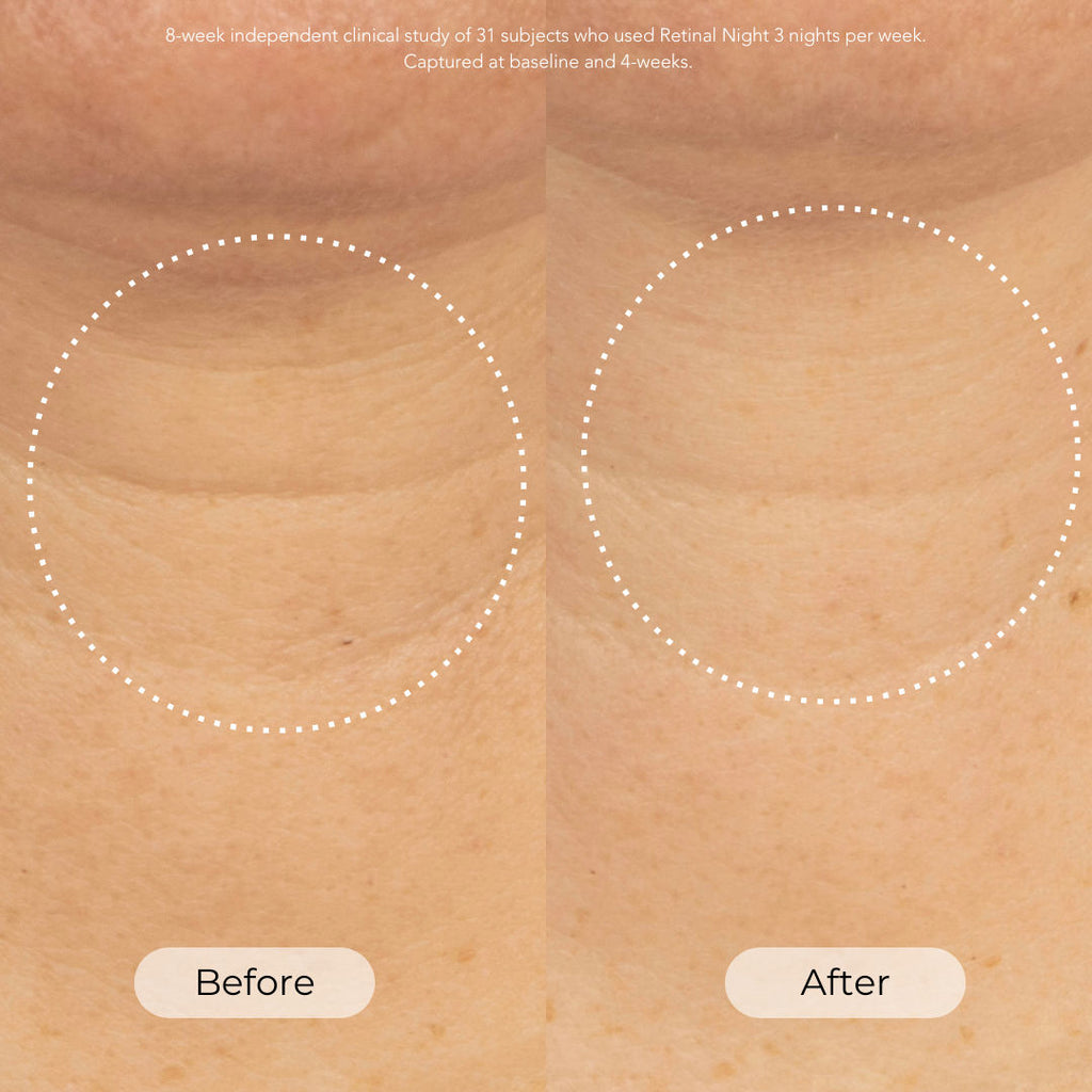 Skin Cycling Program