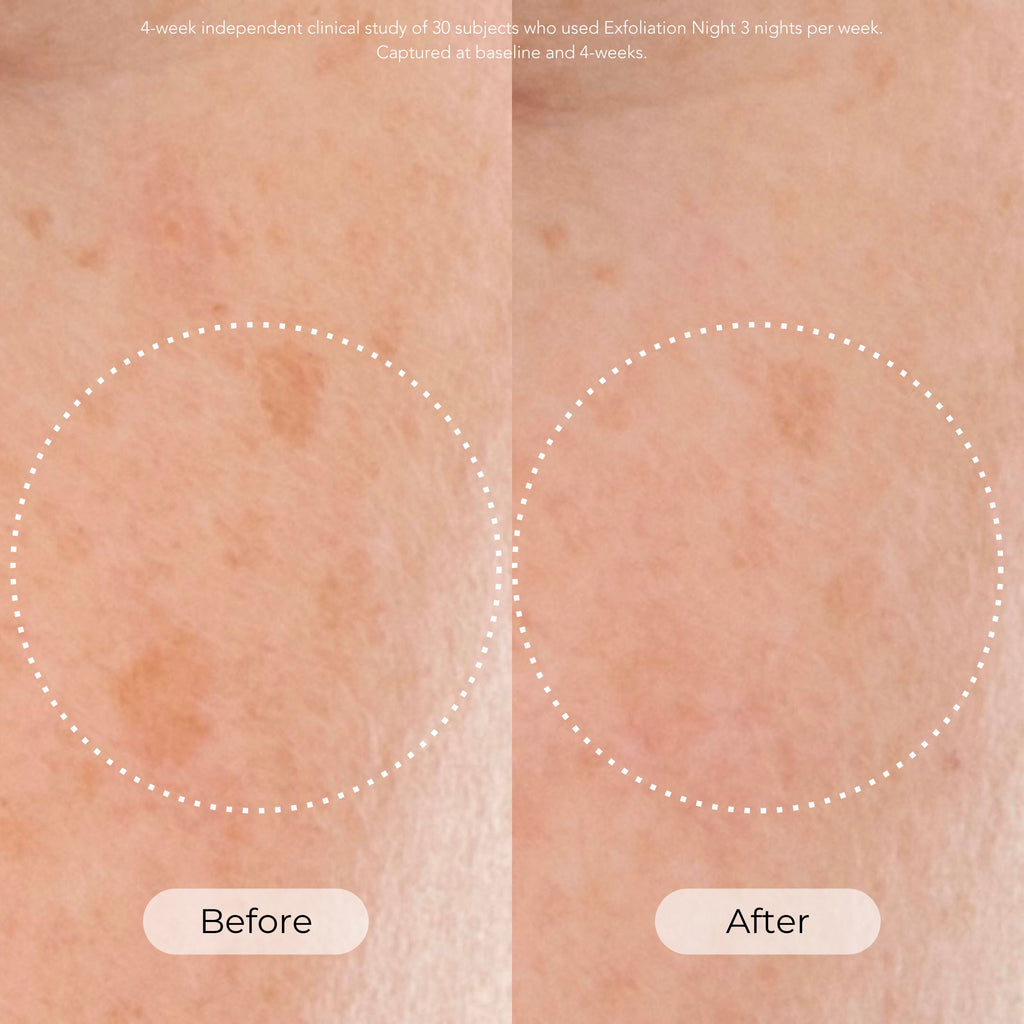 Skin Cycling Program