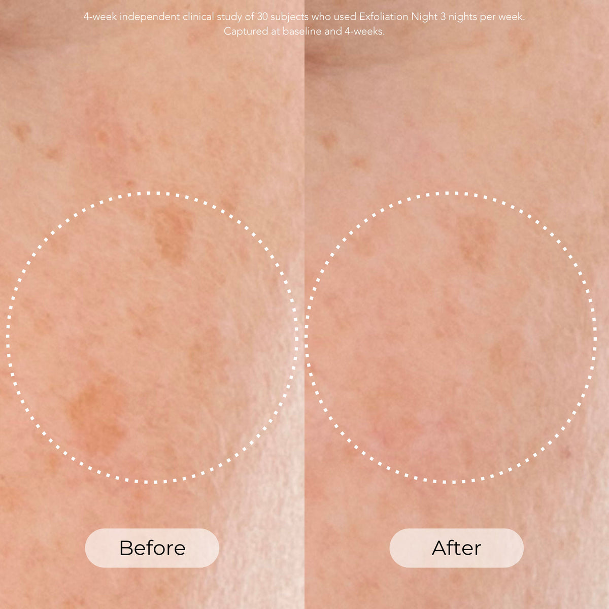 Skin Cycling Program