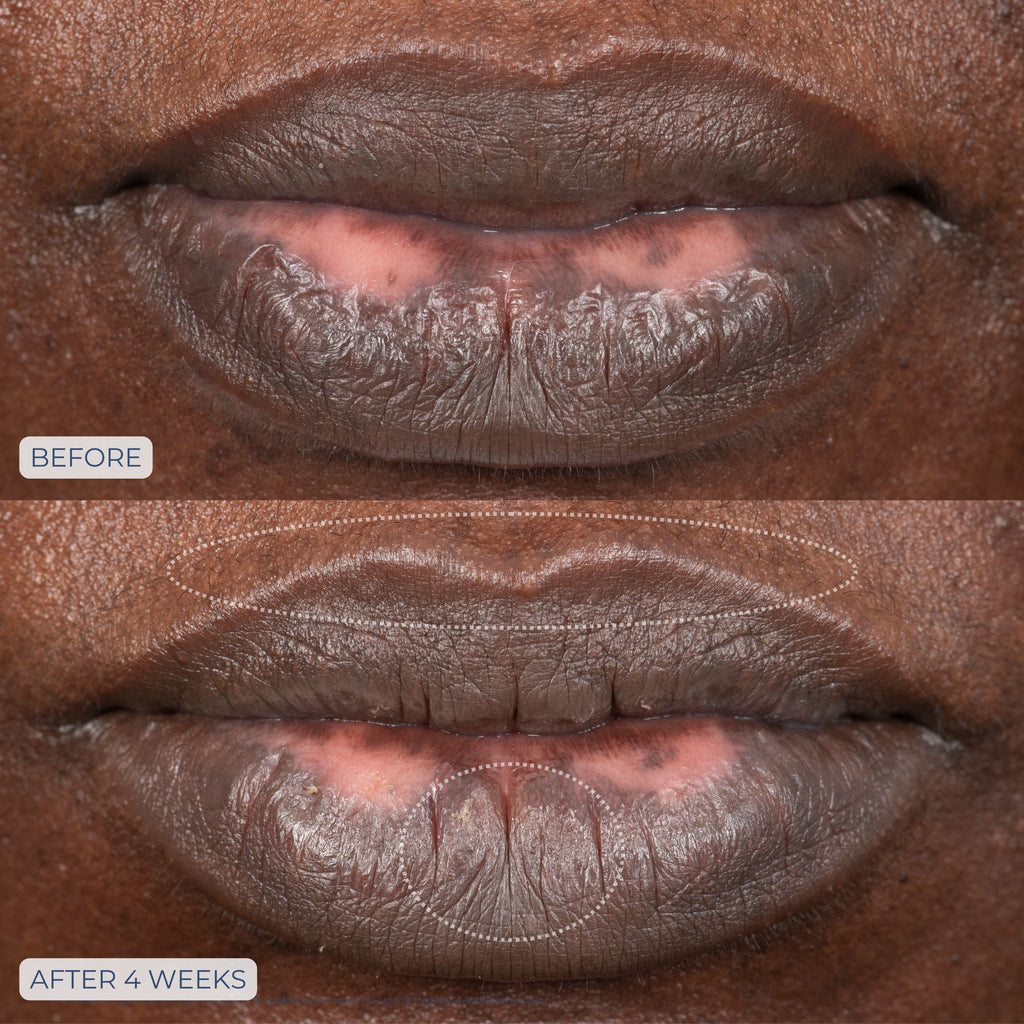 Tri-Liptide Peptide Lip Enhancing Treatment