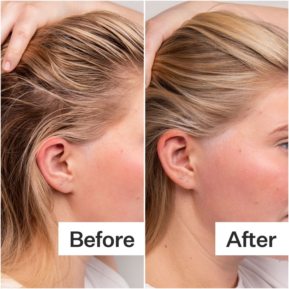 4% Niacinamide Oily Scalp Serum