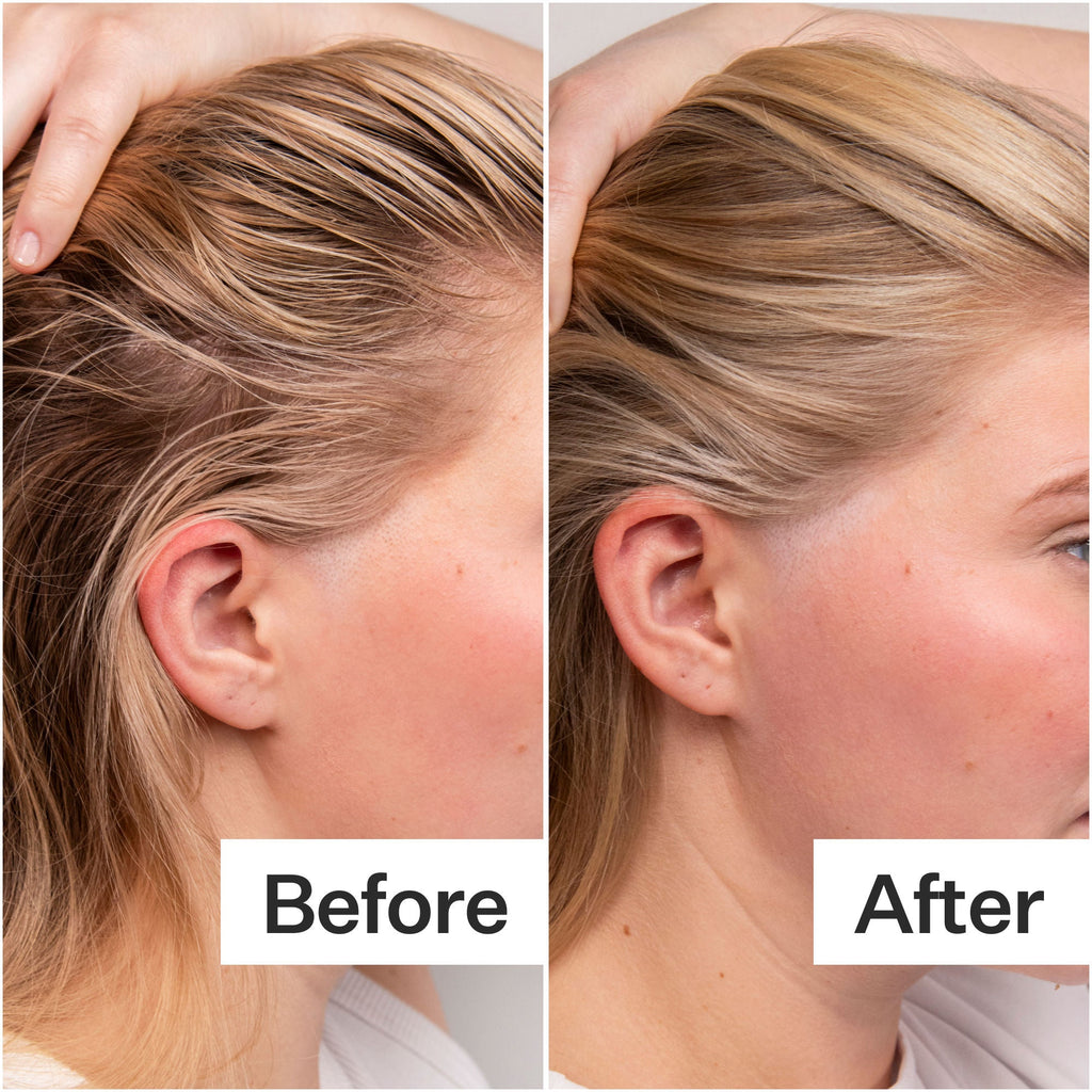 4% Niacinamide Oily Scalp Serum