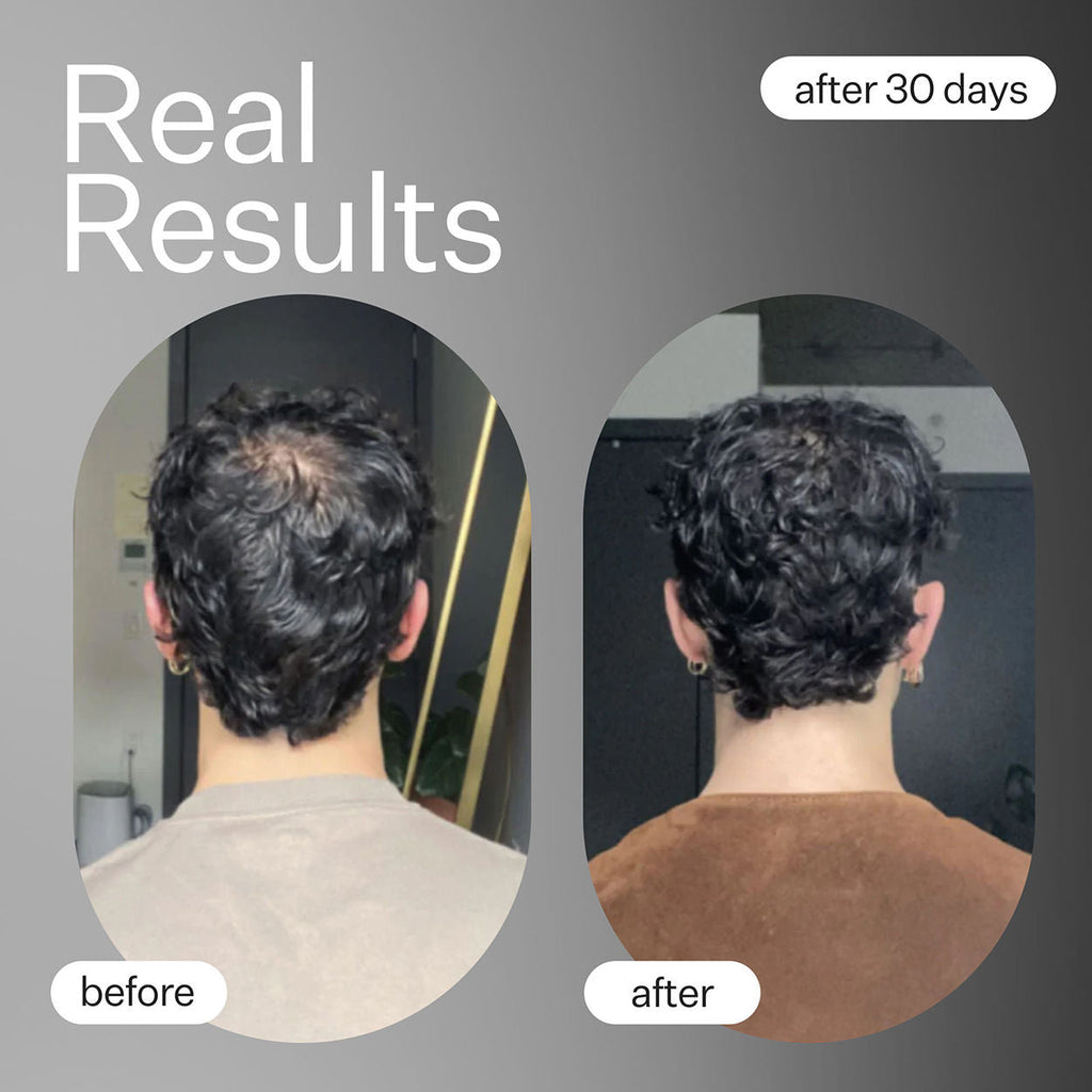 Cold Processed Plant Based Hair Capsules