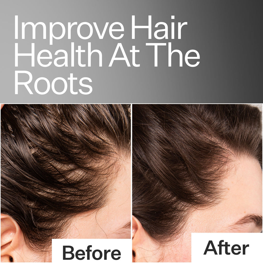 Scalp Relief System