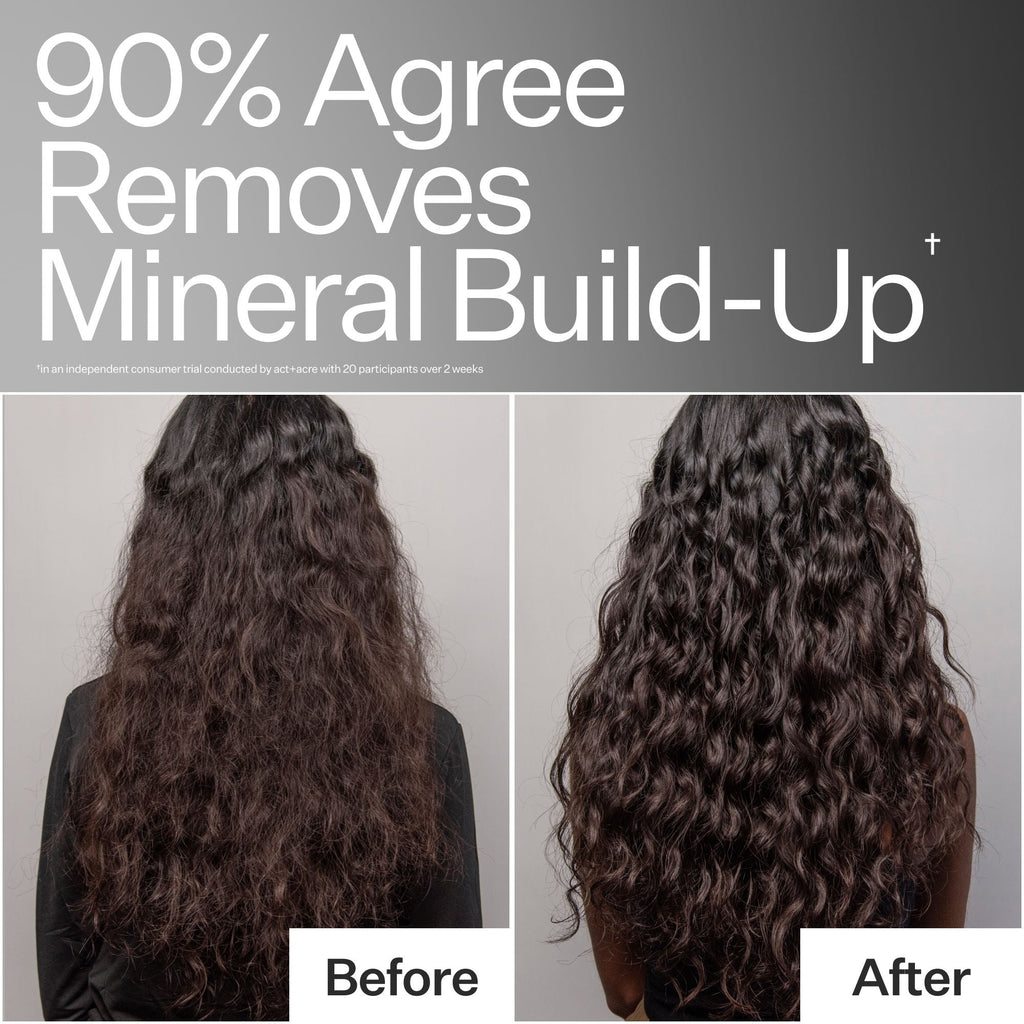 Clarifying Hard Water Scalp Treatment For Scalp + Hair Build-Up