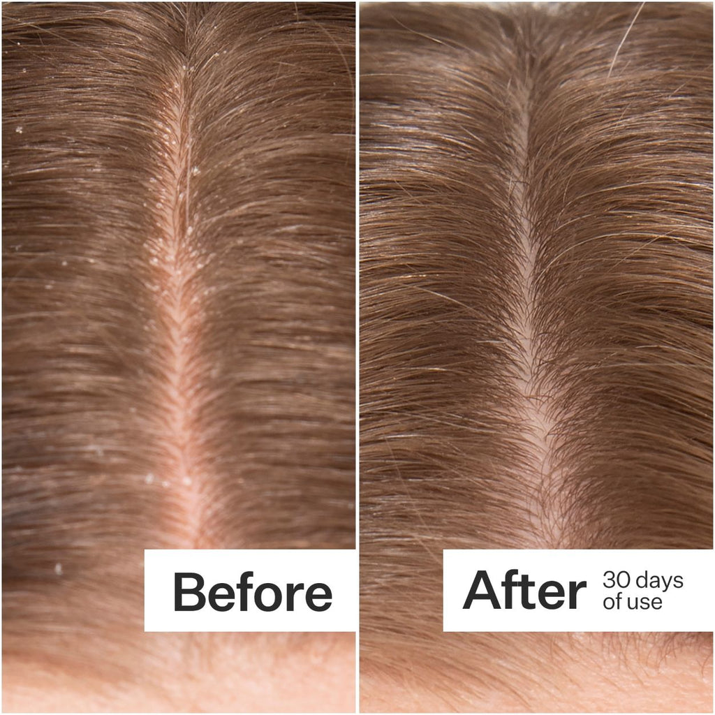 Microbiome Cooling Scalp Serum