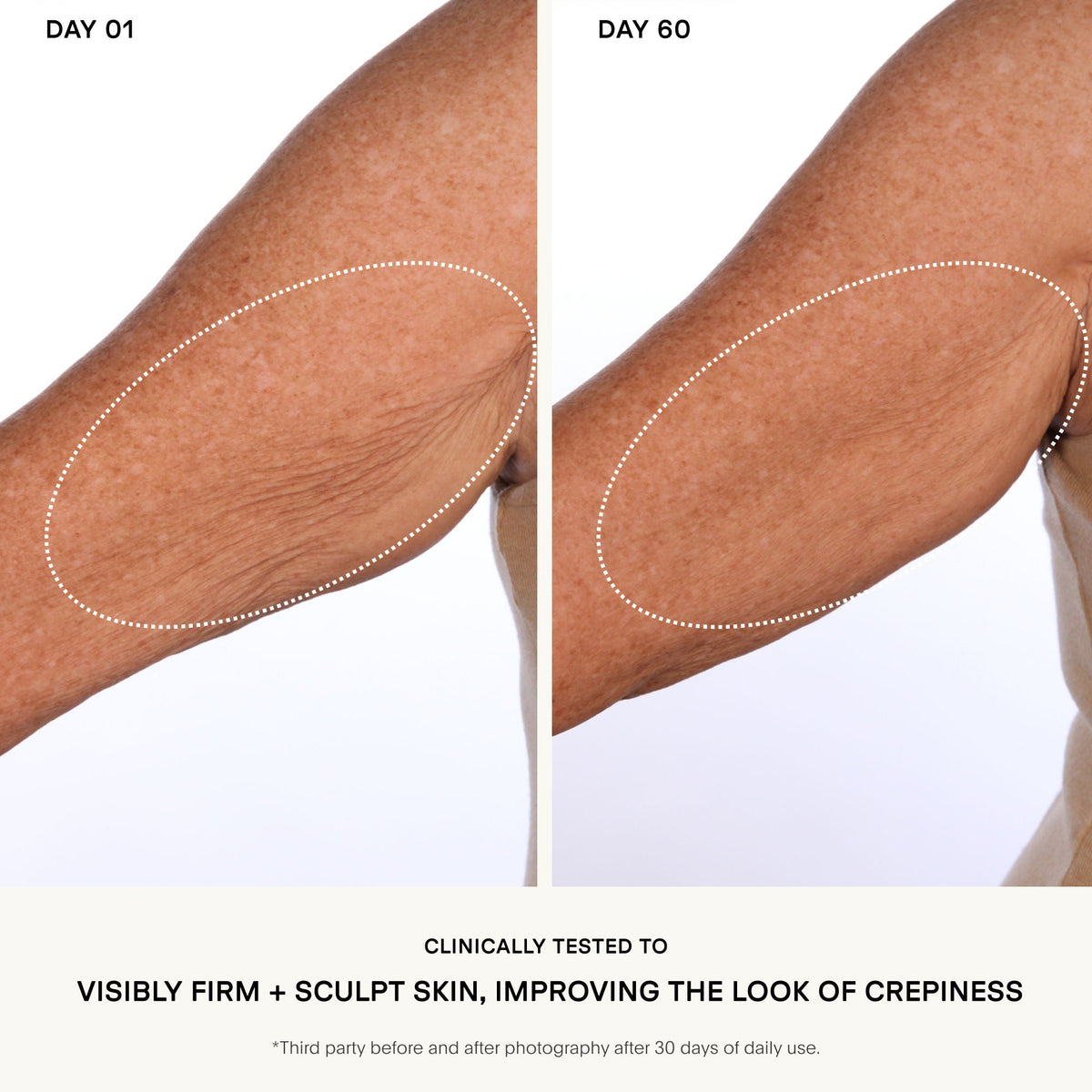 The Sculpt Arm Compound