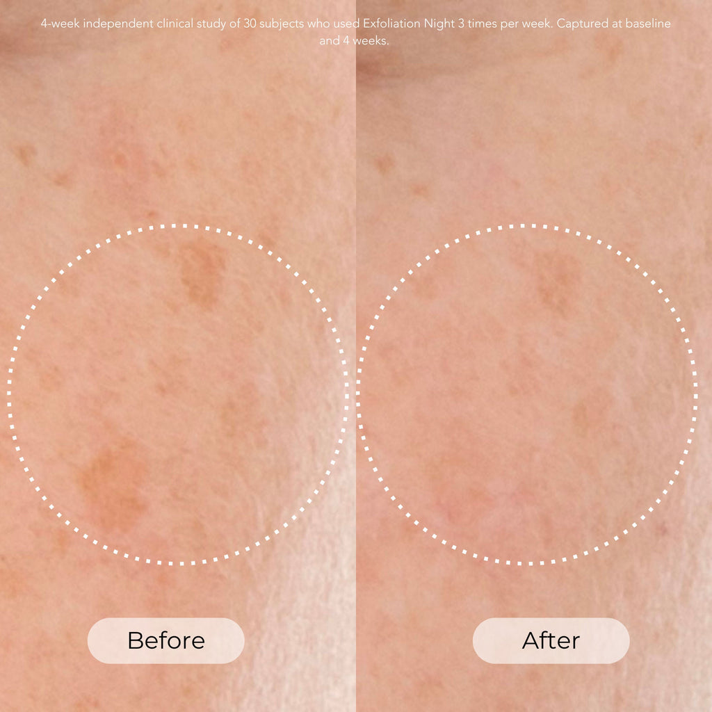 Exfoliation Night Resurfacing and Brightening Serum