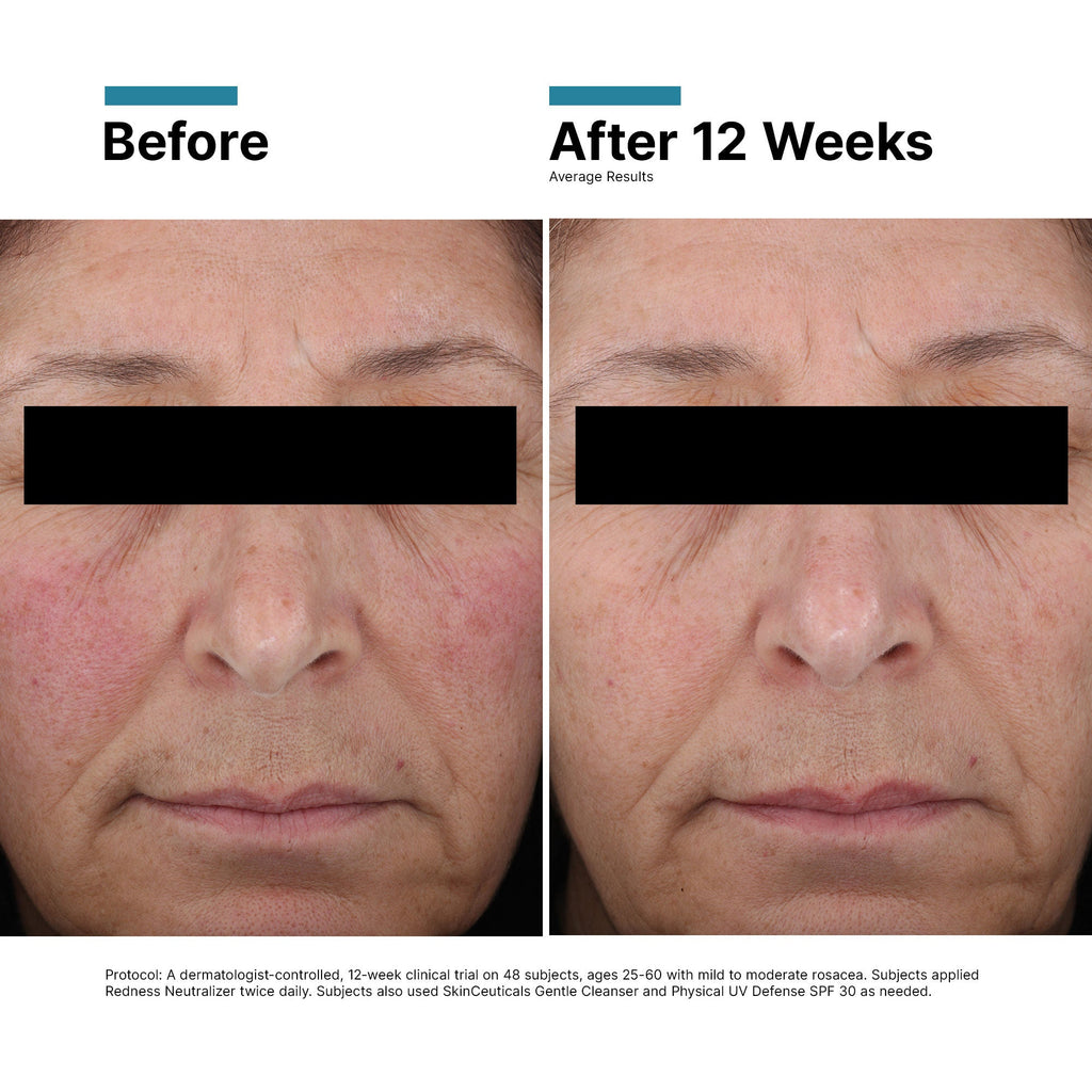 Redness Neutralizer
