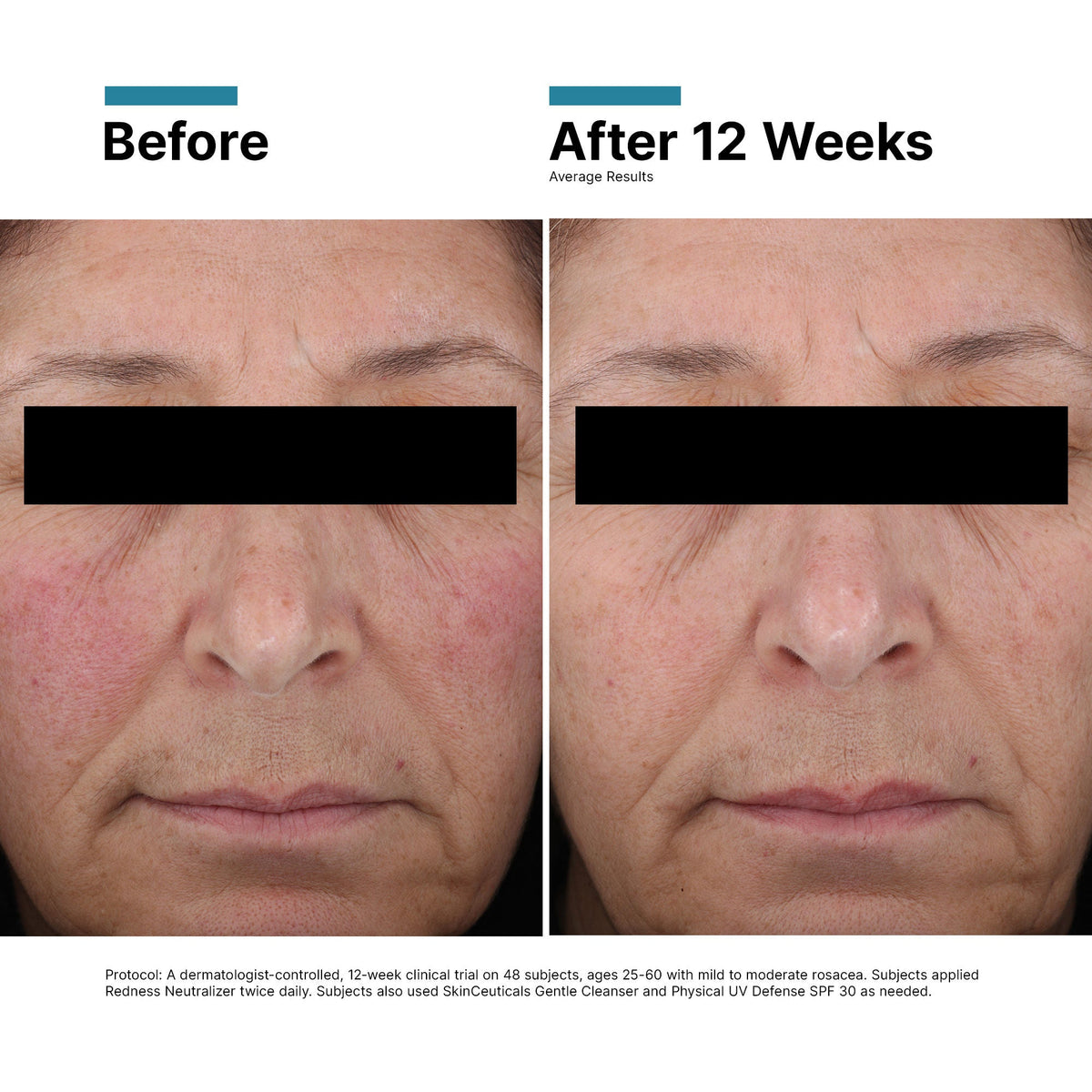 Redness Neutralizer