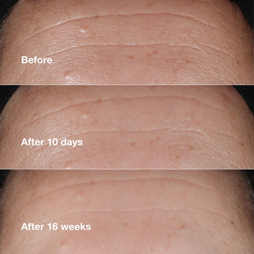 Smart Clinical Repair Wrinkle Correcting Serum
