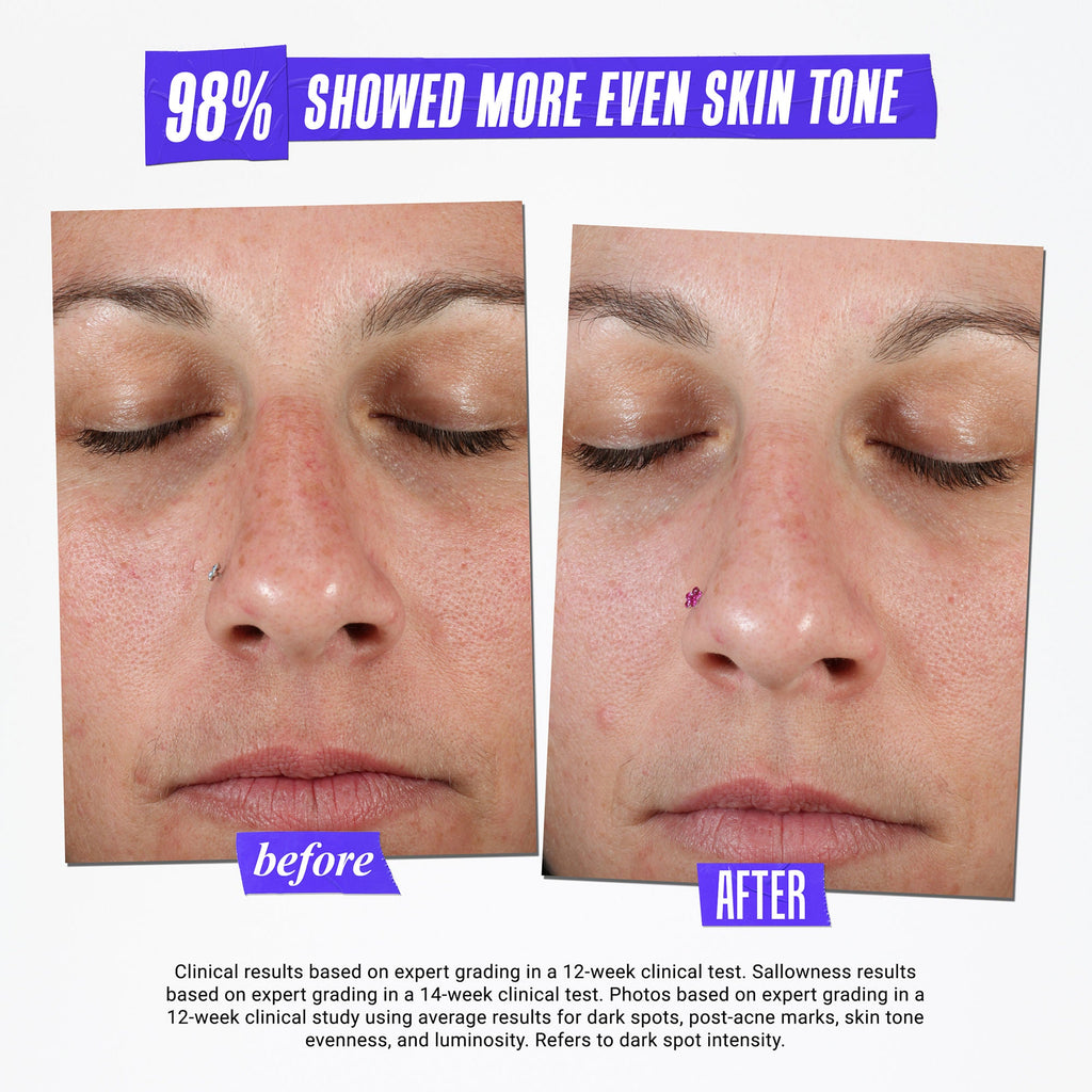 Clearly Corrective Dark Spot Solution