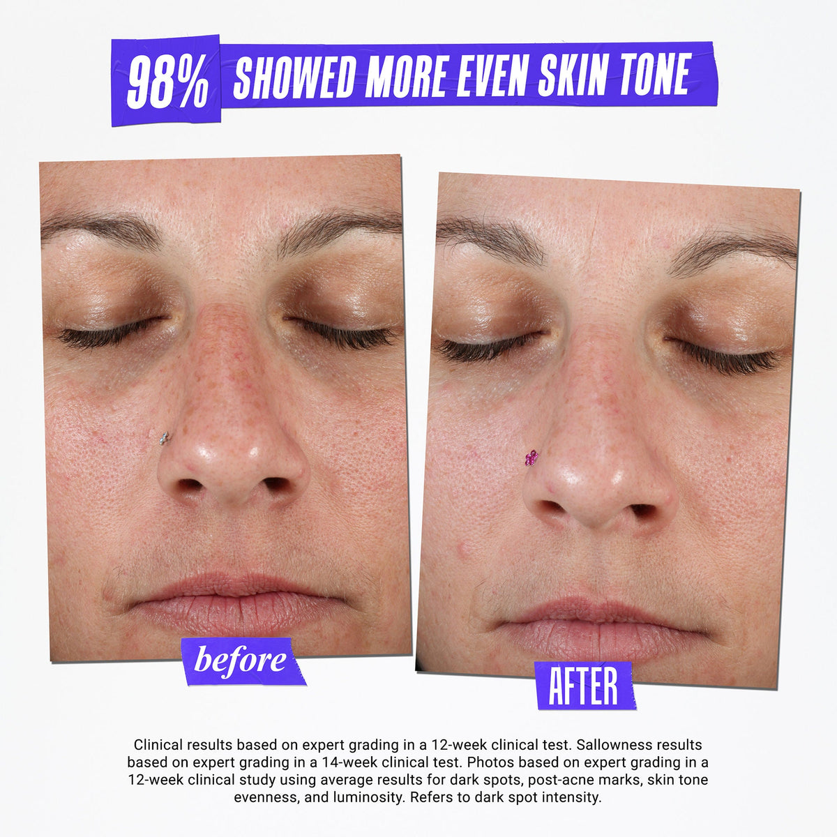 Clearly Corrective Dark Spot Solution