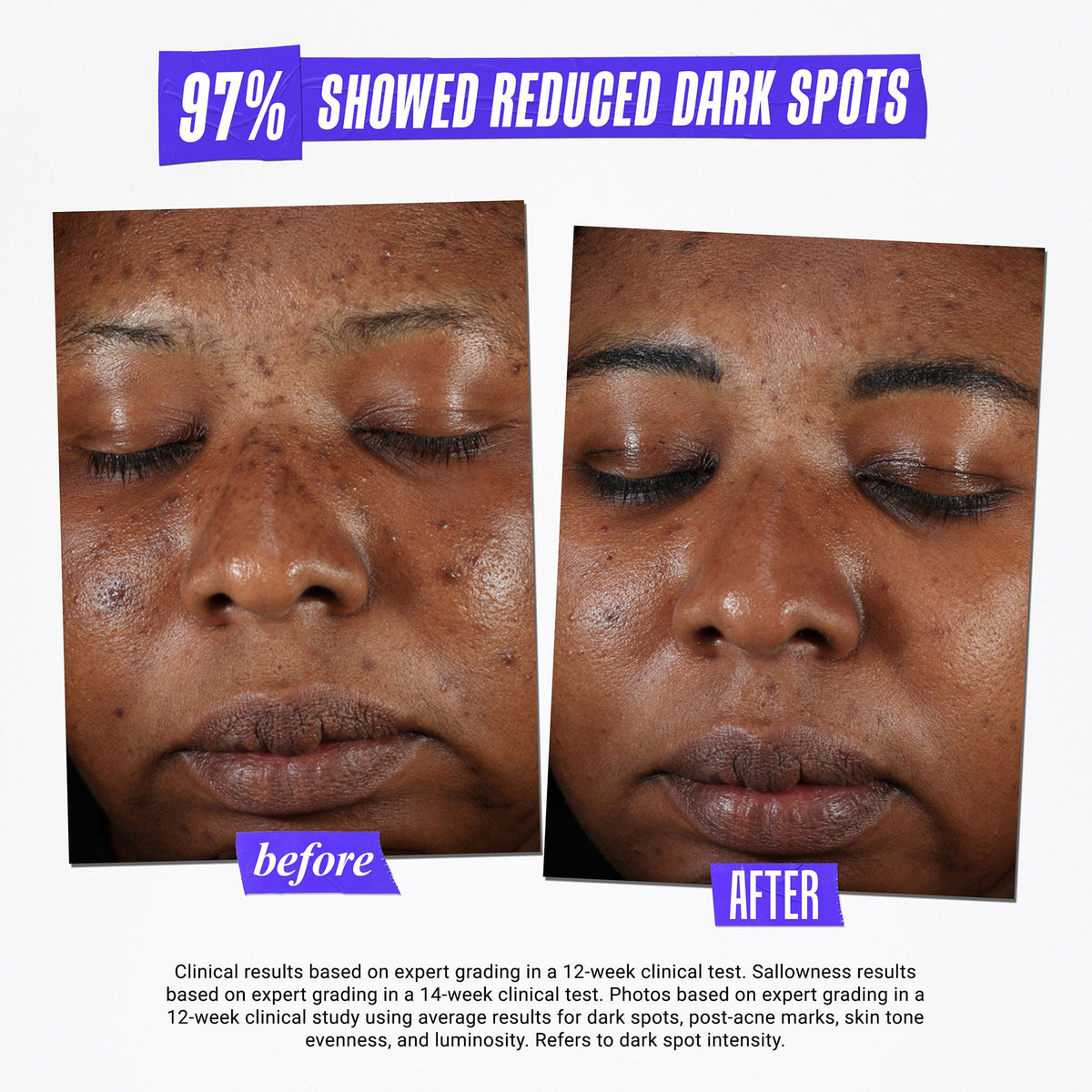 Clearly Corrective Dark Spot Solution