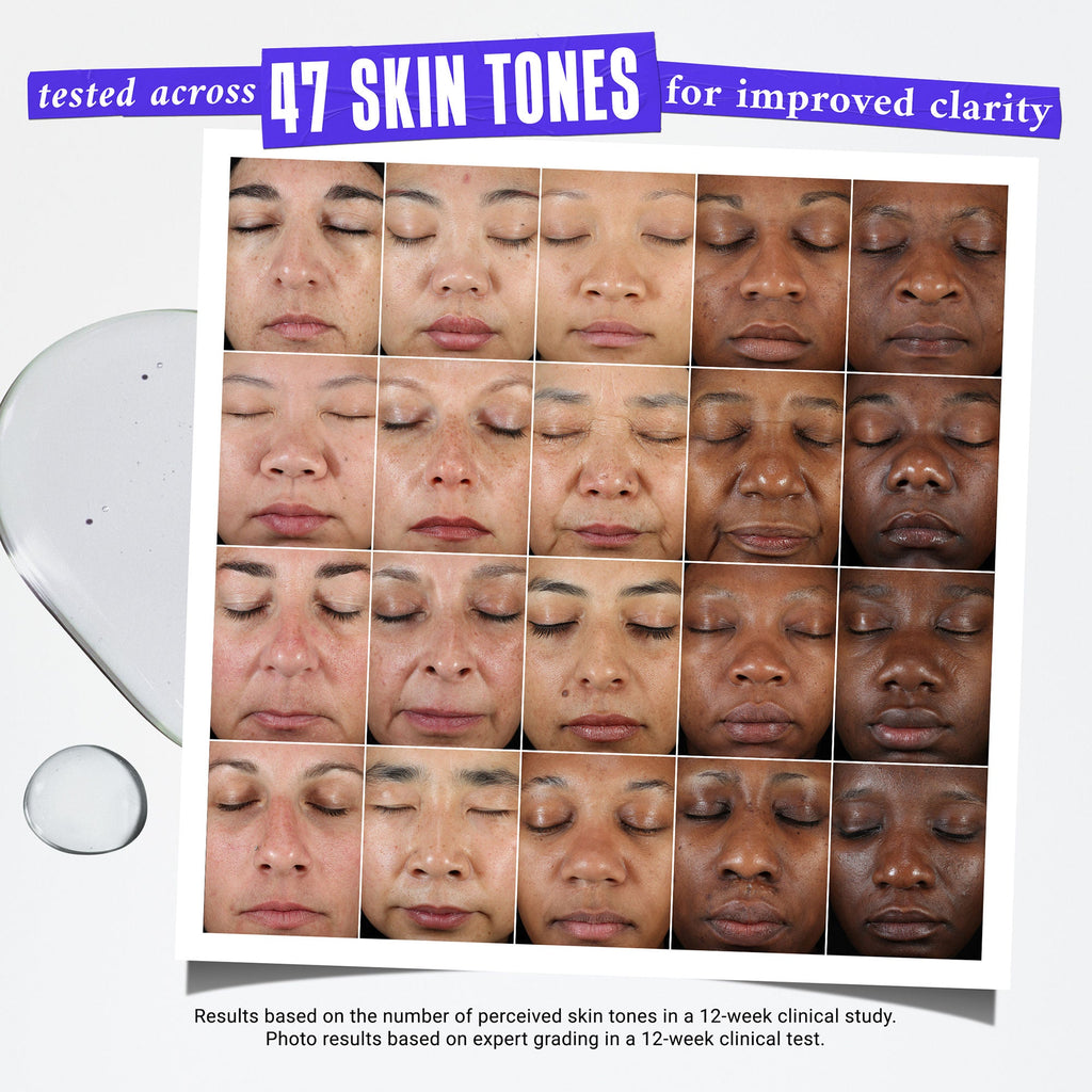 Clearly Corrective Dark Spot Solution
