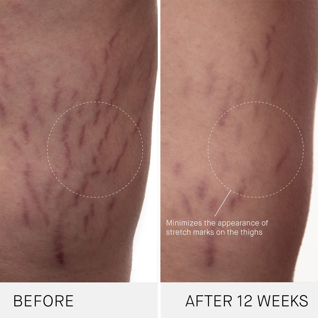 The Body Cream