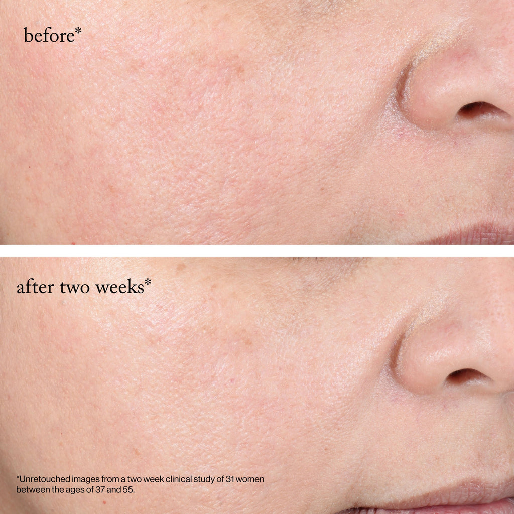 15% Glycolic Acid Overnight Glow Peel