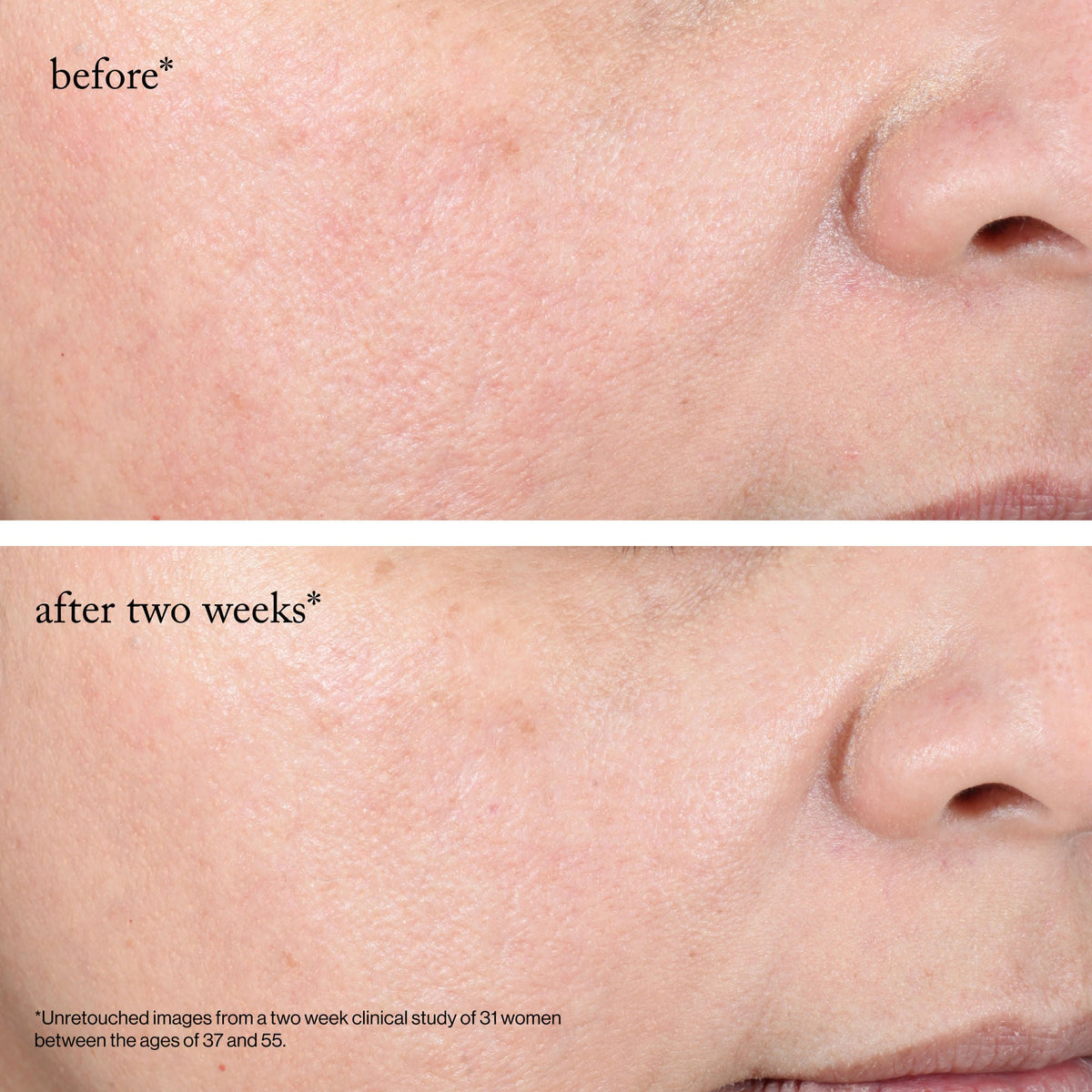 15% Glycolic Acid Overnight Glow Peel